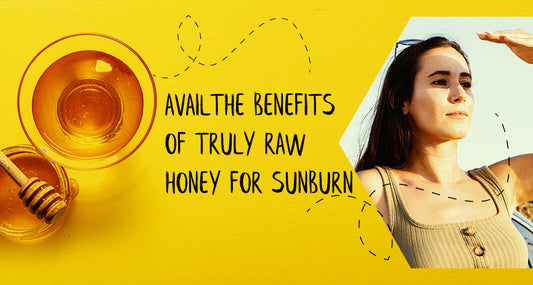 Avail the Benefits of Raw Honey for Sunburn