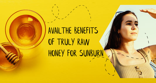 Avail the Benefits of Raw Honey for Sunburn 